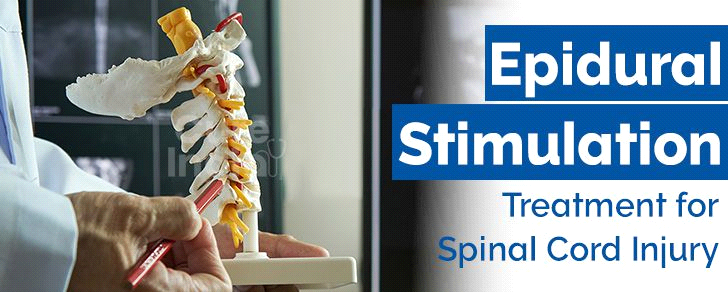 Epidural Stimulation for spinal cord injury
